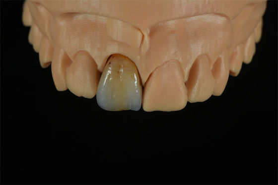 qualidade  Affordable Zirconia Crowns with Custom Color Staining - China Dental Lab fábrica